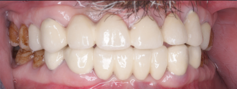 Before image
