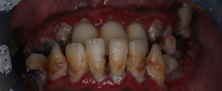 Before image