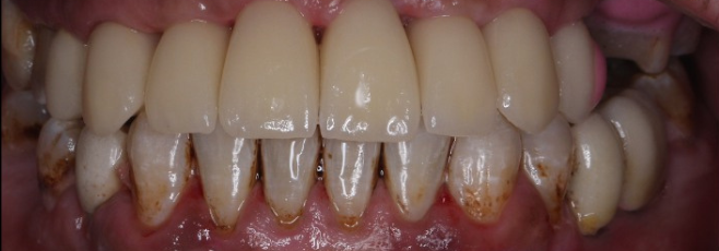Before image