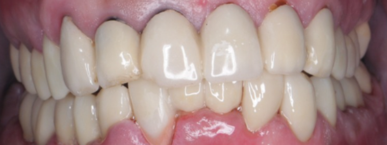 Before image
