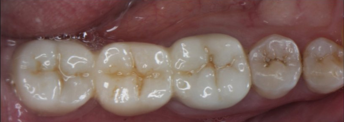 Before image
