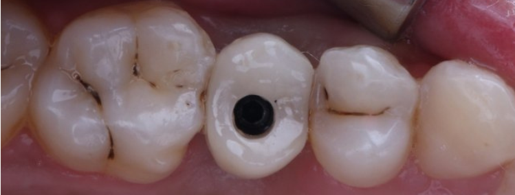 Before image