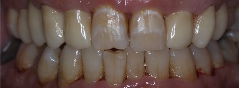 Before image