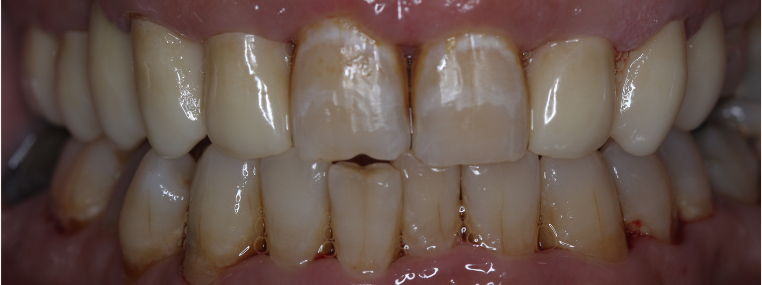 Before image