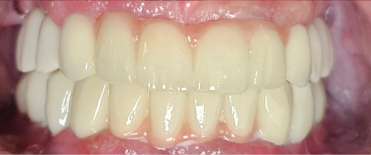 Before image