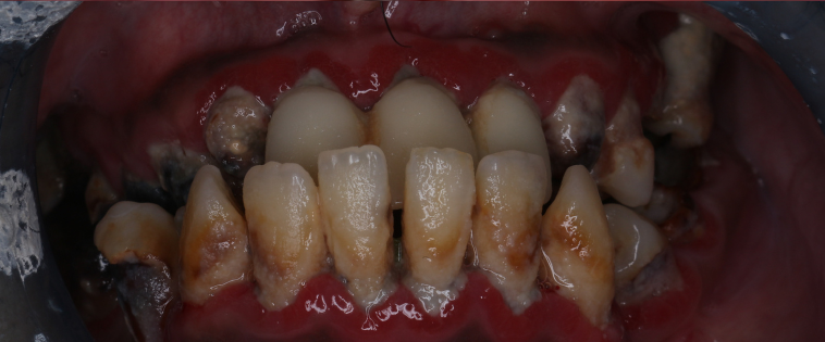 Before image