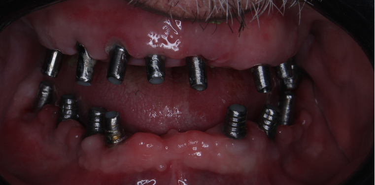 After image