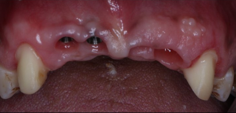After image