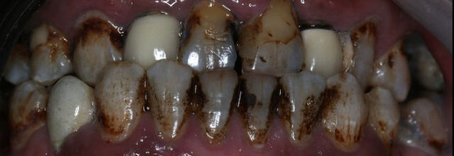 After image