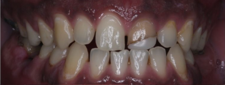 Before image