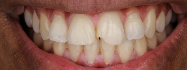 Before image