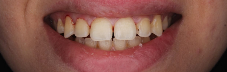 Before image