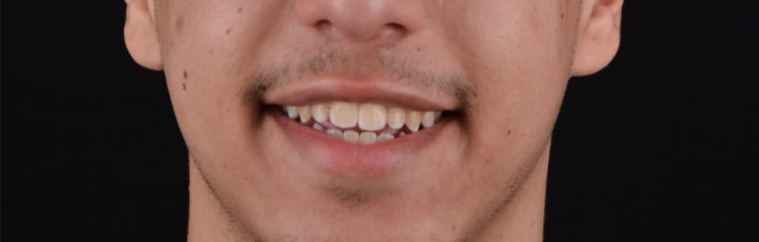 Before image