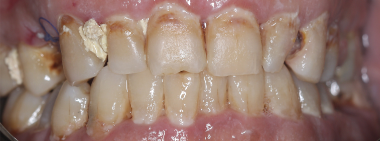After image