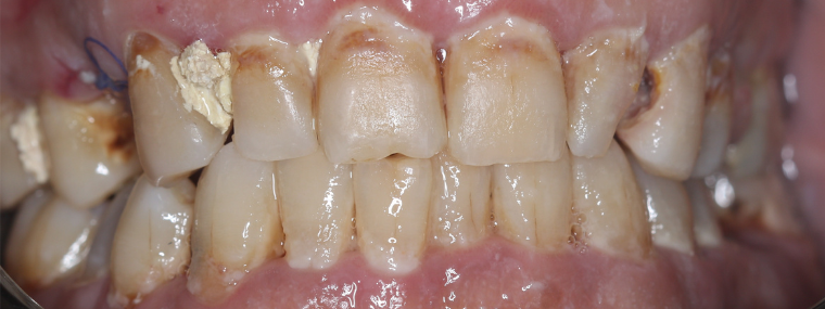After image