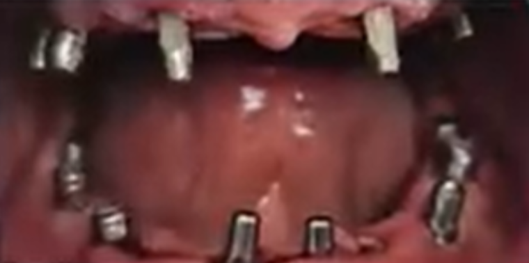 After image