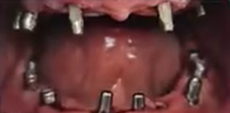 After image